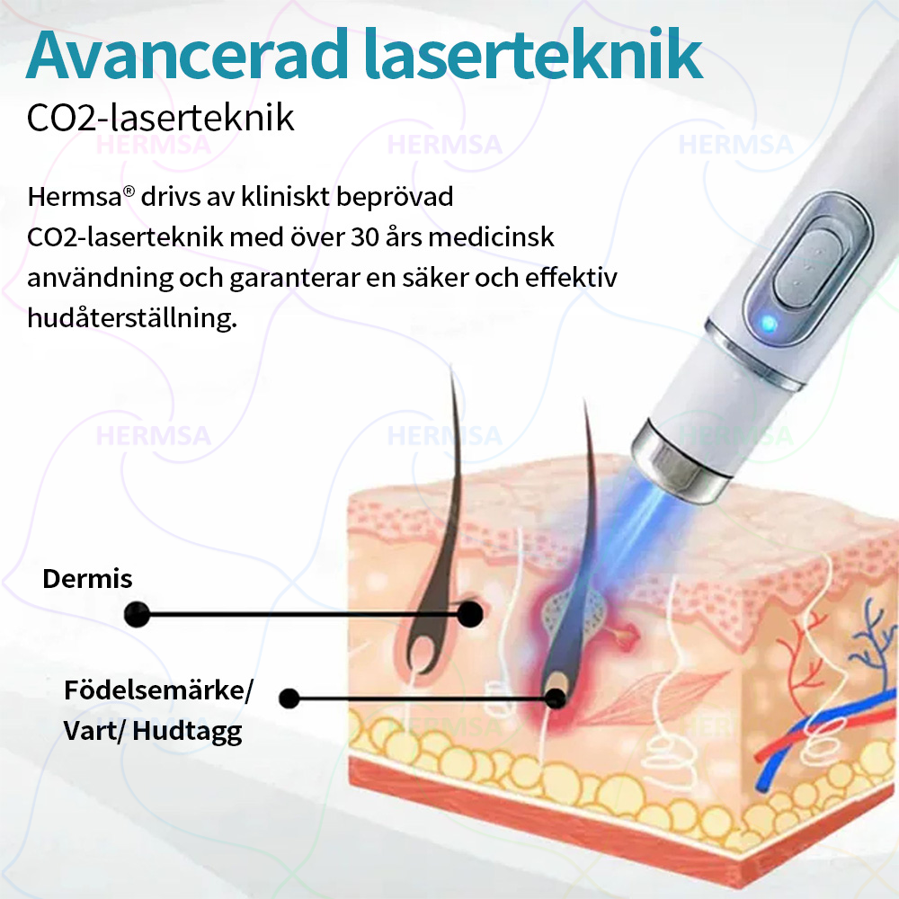 Hermsa® ikke-invasiv laserpointer - fjernelse af modermærker og vorter