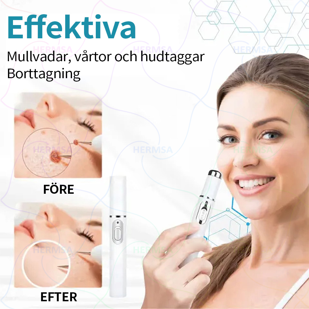 Hermsa® ikke-invasiv laserpointer - fjernelse af modermærker og vorter