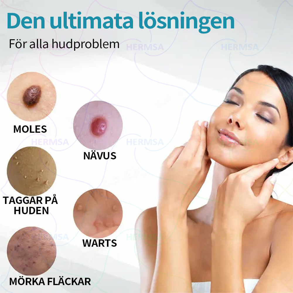 Hermsa® ikke-invasiv laserpointer - fjernelse af modermærker og vorter